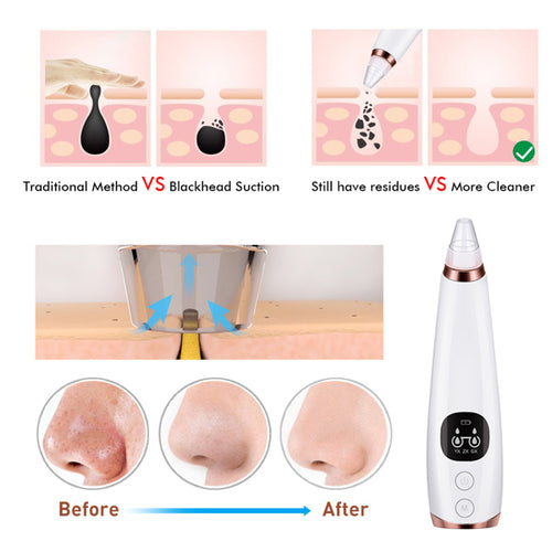 Load image into Gallery viewer, Facial microcry stalline blackhead skin beauty instrument
